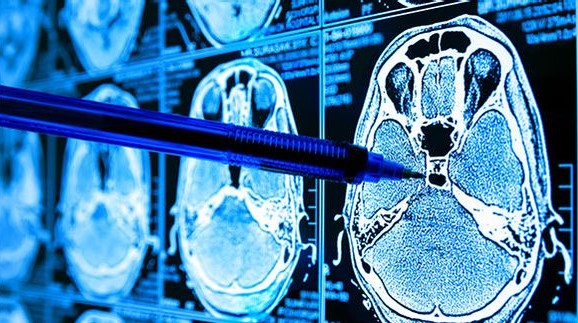 Machine Learning Na Saude