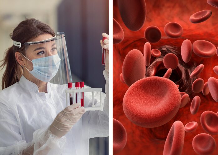Ensino Einstein Realiza2c Simpb3sio Internacional Em Trombose E Hemostasia